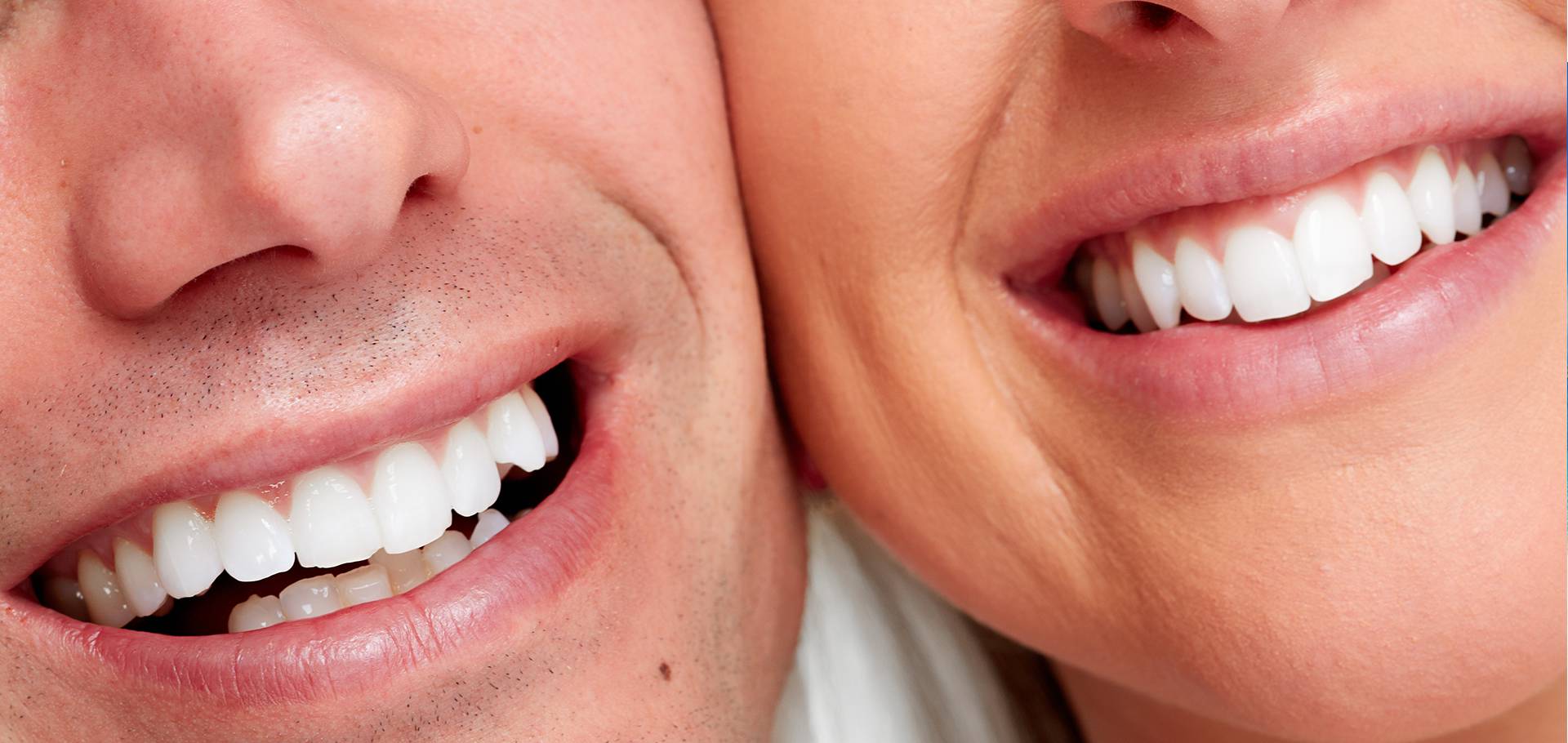 Улыбка Здоровые зубы